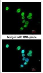RASAL1 Polyclonal Antibody