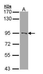 RASAL1 Antibody in Western Blot (WB)