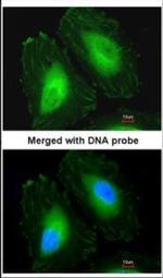 CRYBA4 Polyclonal Antibody