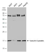 CRYBA4 Antibody in Western Blot (WB)