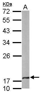 CRYBA4 Antibody in Western Blot (WB)