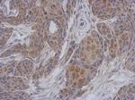 NDUFA12 Antibody in Immunohistochemistry (Paraffin) (IHC (P))