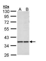 AKR1B10 Antibody in Western Blot (WB)