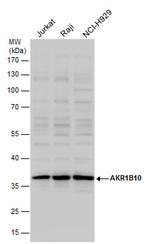 AKR1B10 Antibody in Western Blot (WB)