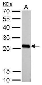 PGAM2 Antibody in Western Blot (WB)