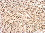 XRCC4 Antibody in Immunohistochemistry (Paraffin) (IHC (P))