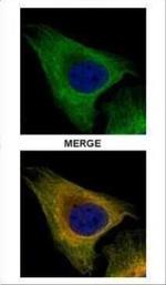 TUBB8 Antibody in Immunocytochemistry (ICC/IF)