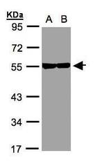 TUBB8 Antibody in Western Blot (WB)