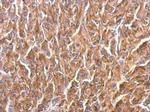 TUBB8 Antibody in Immunohistochemistry (Paraffin) (IHC (P))