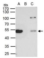TUBB8 Antibody in Immunoprecipitation (IP)