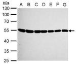 TUBB8 Antibody in Western Blot (WB)