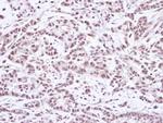 SMC1 Polyclonal Antibody