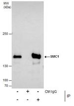 SMC1 Antibody in Immunoprecipitation (IP)