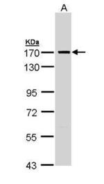 SMC1 Antibody in Western Blot (WB)