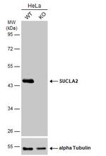 SUCLA2 Antibody in Western Blot (WB)