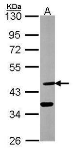 DHH Polyclonal Antibody