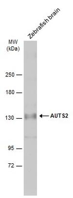 AUTS2 Polyclonal Antibody