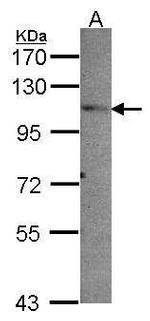 PEX6 Polyclonal Antibody