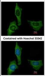 Factor X/Xa Polyclonal Antibody