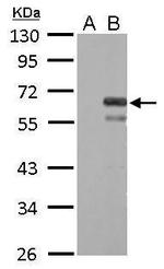 Factor X/Xa Antibody in Western Blot (WB)