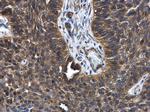 FGD4 Antibody in Immunohistochemistry (Paraffin) (IHC (P))
