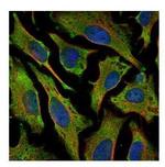 Villin Polyclonal Antibody