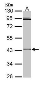 CRLF1 Polyclonal Antibody