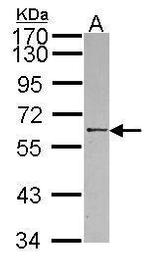 RBMY1A1 Polyclonal Antibody