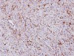 TREH Polyclonal Antibody