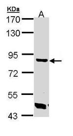 TREH Antibody in Western Blot (WB)