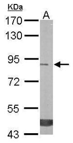 TREH Antibody in Western Blot (WB)