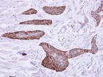 MCD Antibody in Immunohistochemistry (Paraffin) (IHC (P))