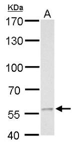 MCD Antibody in Western Blot (WB)