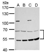 MCD Antibody in Western Blot (WB)