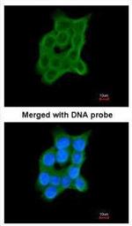 CRTAP Polyclonal Antibody