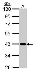 CRTAP Antibody in Western Blot (WB)