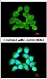 LARS2 Antibody in Immunocytochemistry (ICC/IF)