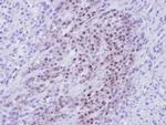 RBMY1A1 Polyclonal Antibody