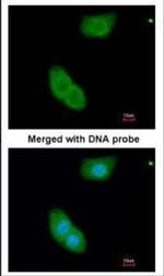 EHBP1 Polyclonal Antibody