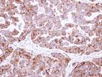 Fumarase Antibody in Immunohistochemistry (Paraffin) (IHC (P))