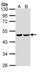 Fumarase Antibody in Western Blot (WB)