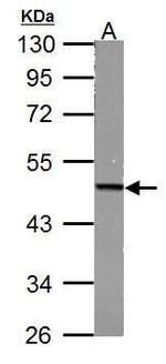 Fumarase Antibody in Western Blot (WB)