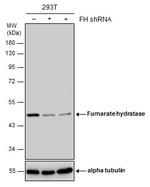 Fumarase Antibody in Western Blot (WB)