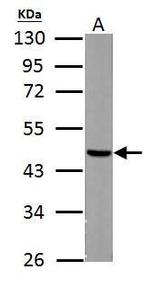 Fumarase Antibody in Western Blot (WB)