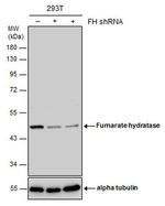 Fumarase Antibody