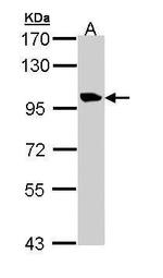 TMEM67 Polyclonal Antibody