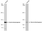 GLDC Antibody in Western Blot (WB)