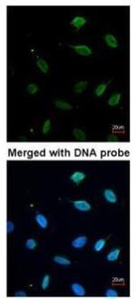 MCM7 Polyclonal Antibody