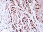 MCM7 Antibody in Immunohistochemistry (Paraffin) (IHC (P))