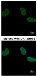 Aminoacylase Polyclonal Antibody